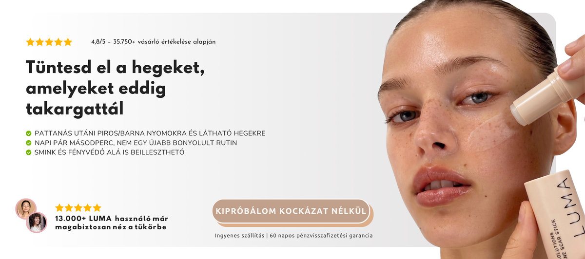 Tüntesd el a hegeket, amelyeket eddig takargattál – LUMA Hegkezelő stift