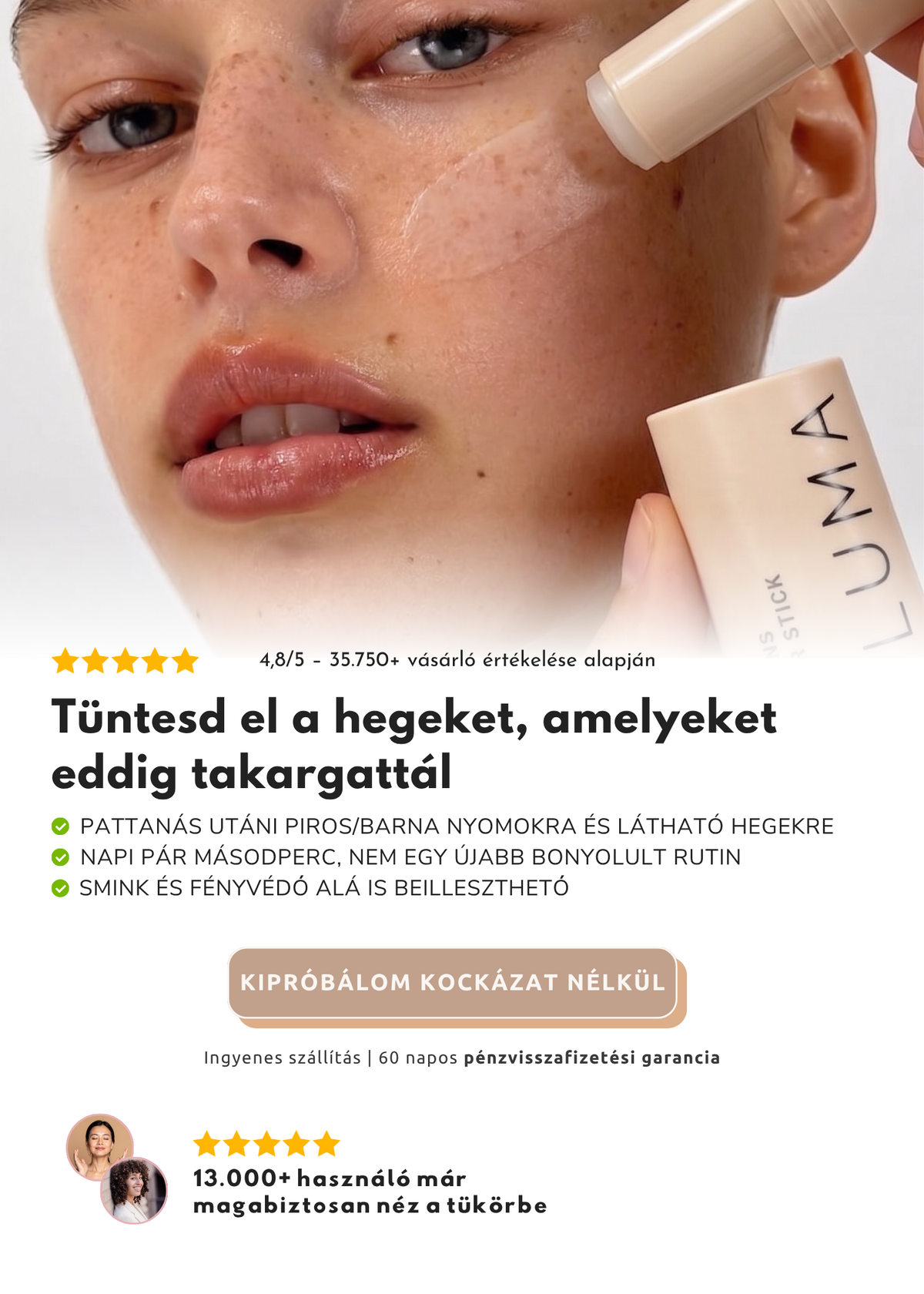Tüntesd el a hegeket, amelyeket eddig takargattál – LUMA Hegkezelő stift